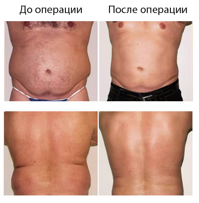 Результат операции
